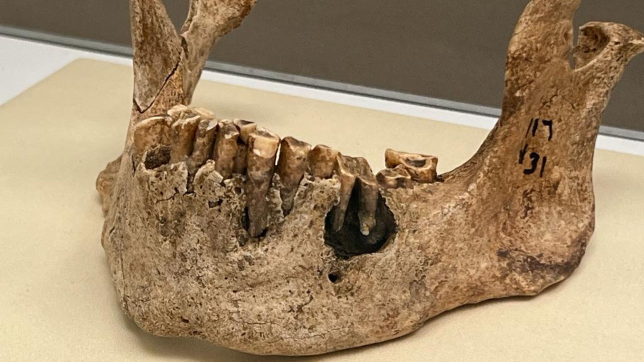 IL CIMITERO 117 E L’ORTODONZIA